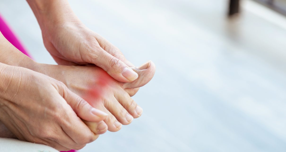 Kobieta z zapaleniem stawów trzyma się za bolącą stopę
