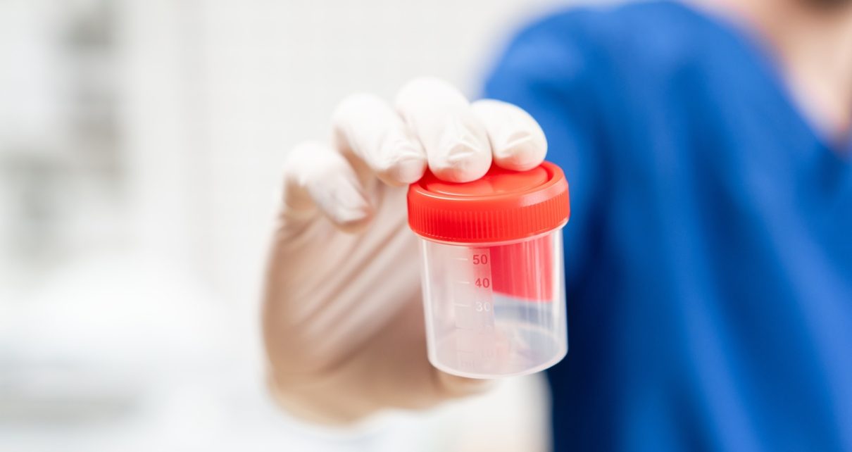 Jakie badania zrobić „na start”, gdy coś nie gra w układzie moczowym?