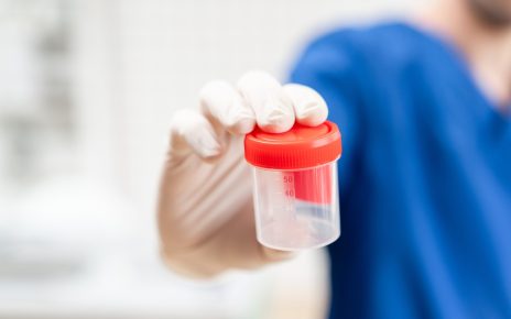 Jakie badania zrobić „na start”, gdy coś nie gra w układzie moczowym?